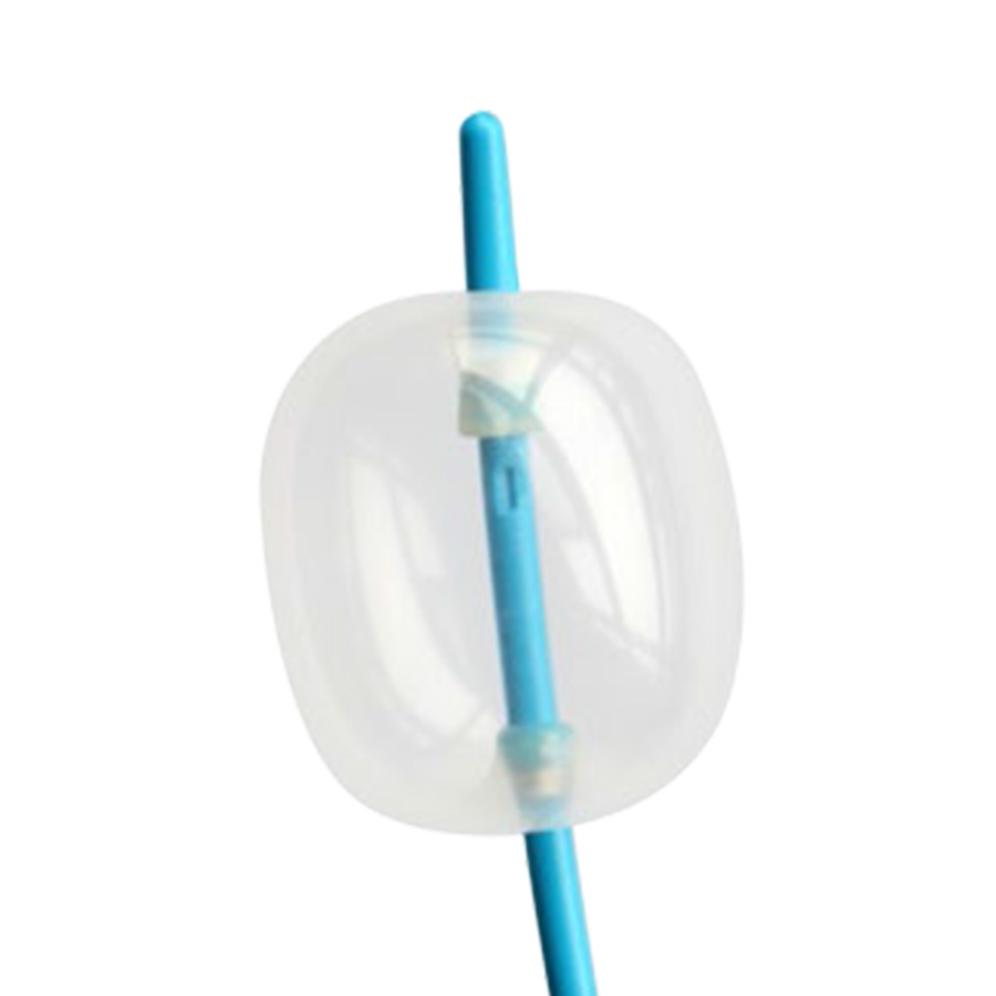 Stone-Extraction-Balloons CBD Balloon